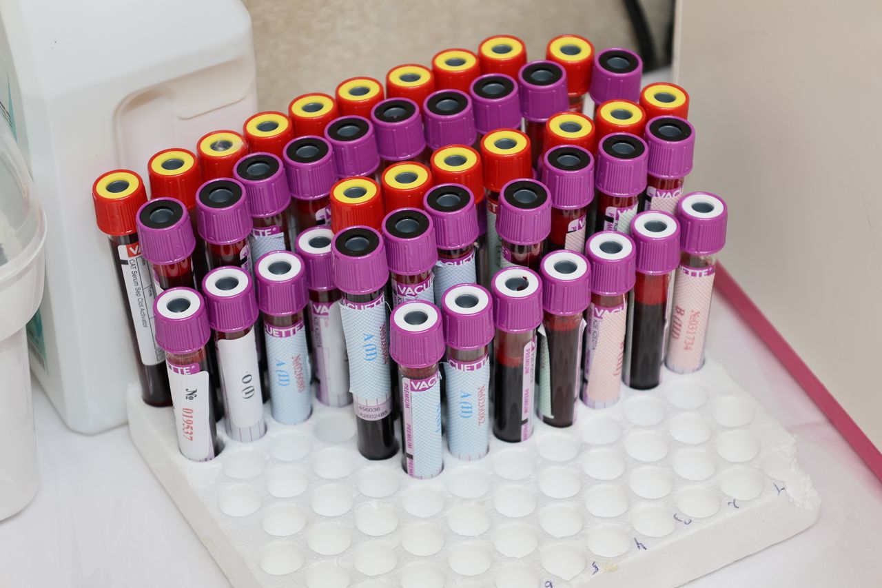 Understanding Blood Tests: What Patients Should Know Rows of blood vials in a laboratory setting, ready for analysis.
