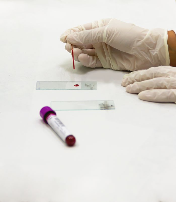 A lab technician in gloves preparing a blood sample with a microscope slide in a laboratory setting.