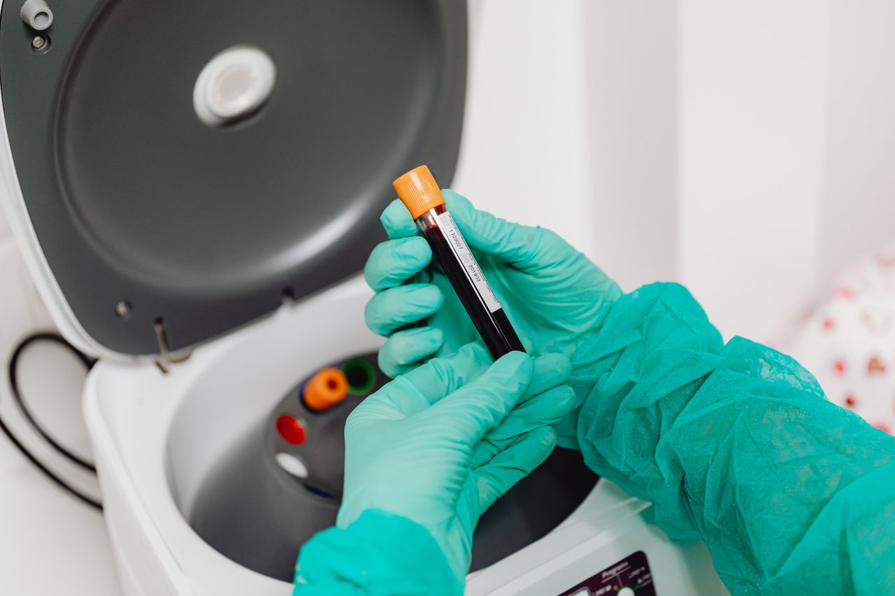 gallery-03 Laboratory scene with a healthcare professional preparing a blood sample for analysis using a centrifuge.