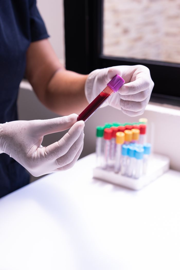 gallery-02 A healthcare worker examines a blood sample in test tubes, emphasizing medical precision and care.